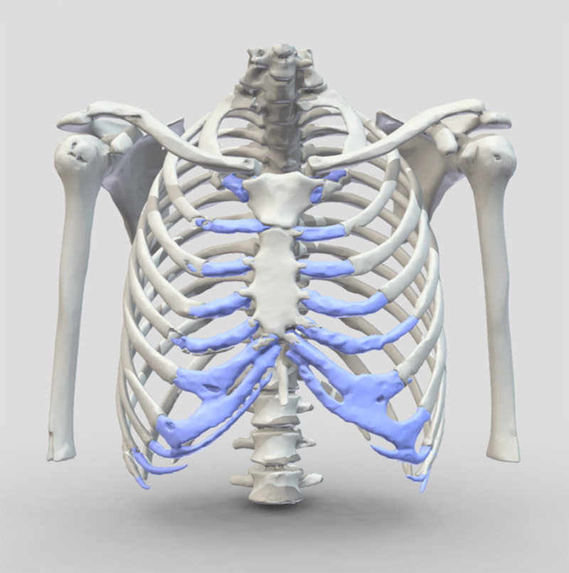 Female rib cages tend to be longer and more narrow, while male